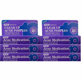 Acne Medication Benzoyl Peroxide Gel 10%  1.5 oz Each by Rugby ( 6 Pack) 